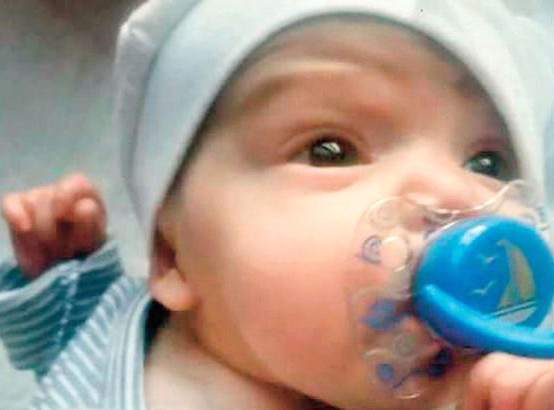 Dünyada 9 Kişide Görülen Hastalığa Yakalanan Mavi Bebeğin, Tek Çaresi İlik Nakli
