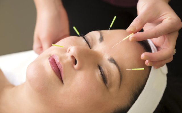 Akupunktur Ve Ağrı Tedavisi